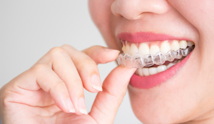 Why Should I Feel Confident in Choosing Invisalign for my Orthodontic Treatment?