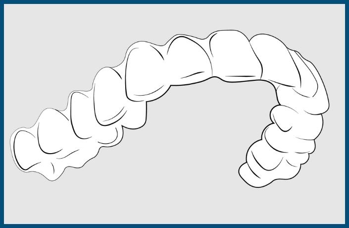 placement of upper clear plastic retainer