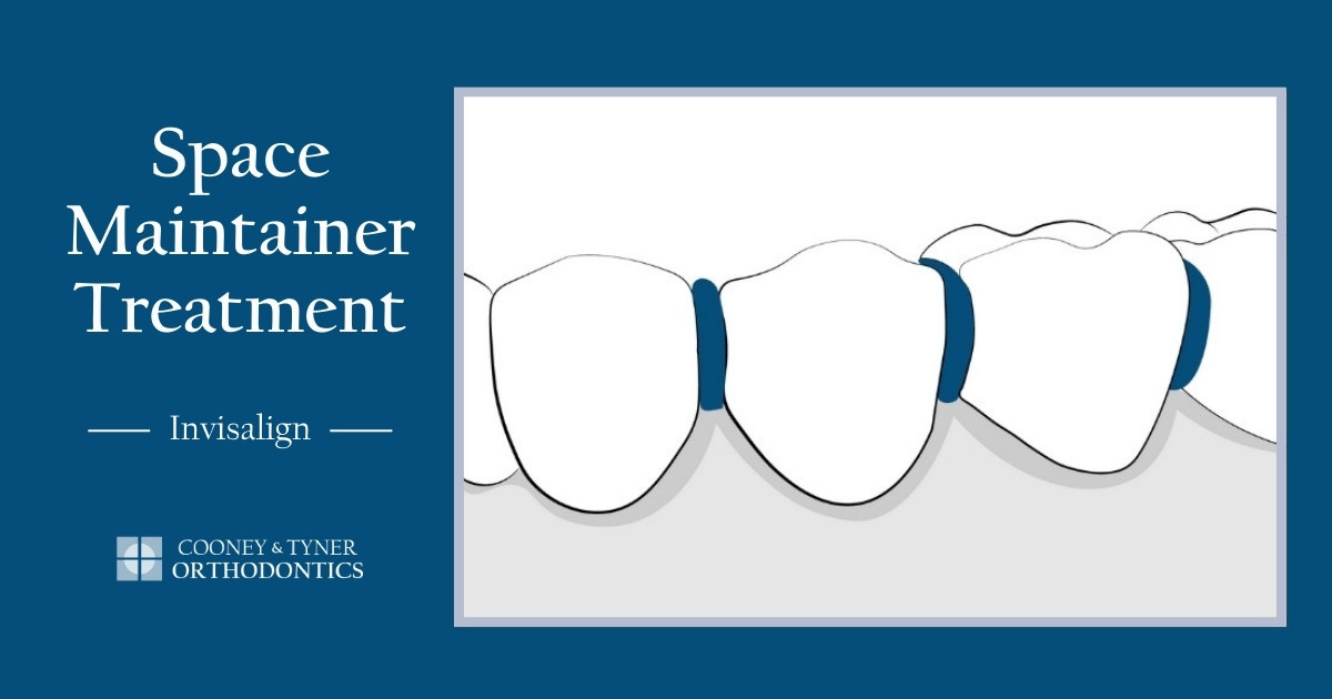 Space Maintainer Treatment Steps For Invisalign Patients
