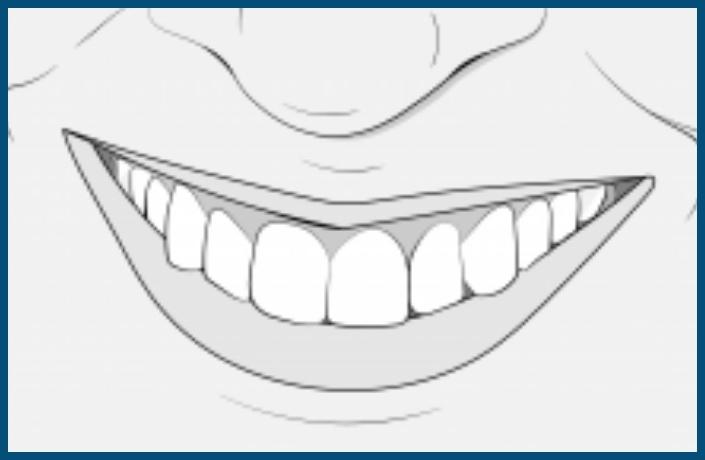 Orthodontic Treatment Step