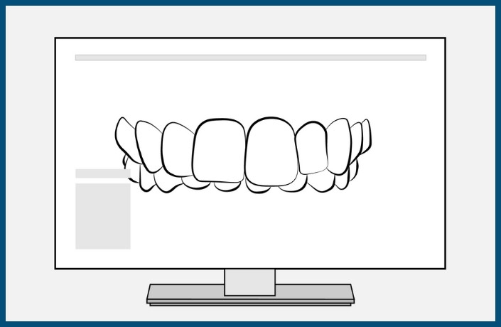 Orthodontic Treatment Step: 3D Imagining