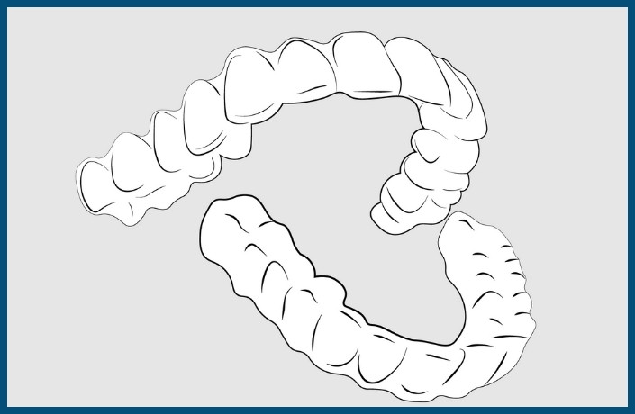 Orthodontic Treatment Step: Placement of Clear Retainers